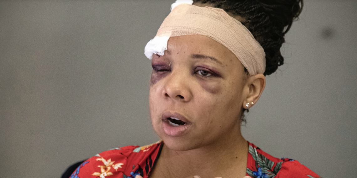press conference rubber bullet Ratlieff Fort Lauderdale police Ramos investigation apology