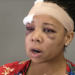 press conference rubber bullet Ratlieff Fort Lauderdale police Ramos investigation apology