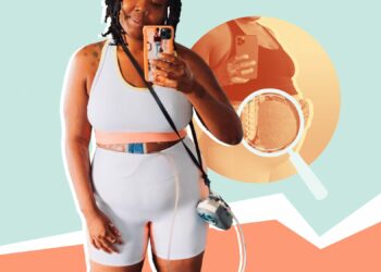 tumor, Chante Burkett, misdiagnosed, gain, medical racism