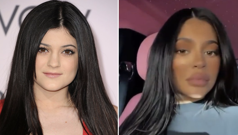 Kylie Jenner blackfishing Kardashians