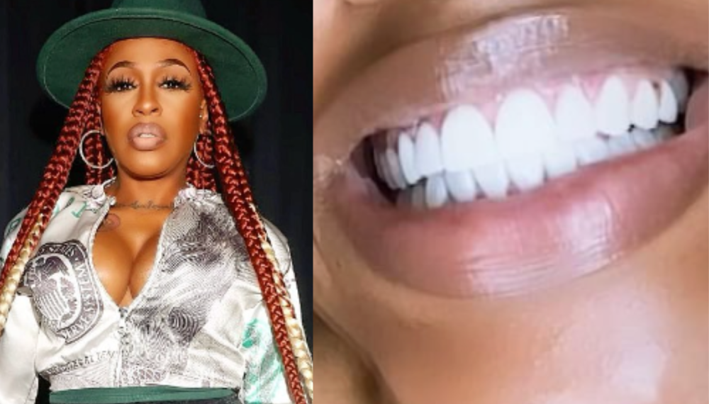 Dr. Toro, dentist, Lil' Mo, singer, veneers, smile, Instagram, posts,