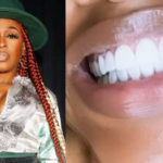 Dr. Toro, dentist, Lil' Mo, singer, veneers, smile, Instagram, posts,