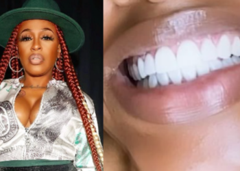 Dr. Toro, dentist, Lil' Mo, singer, veneers, smile, Instagram, posts,