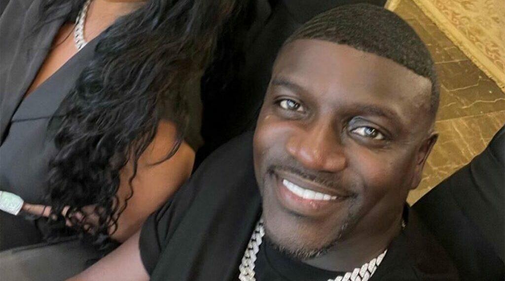 cost, Turkey, Twitter, Black, podcast, The Bootleg Kev, hair transplant, procedure, Akon, singer