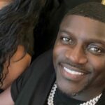 cost, Turkey, Twitter, Black, podcast, The Bootleg Kev, hair transplant, procedure, Akon, singer