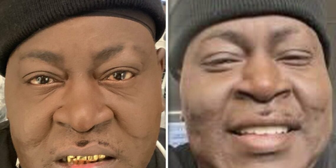 Trick Daddy teeth decay tooth grills
