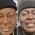 Trick Daddy teeth decay tooth grills