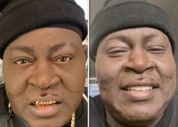 Trick Daddy teeth decay tooth grills